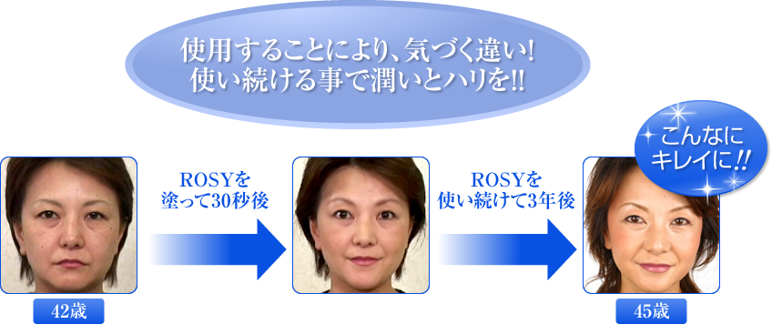 違いは一目遼然！！ 驚きの圧倒的な変化！使い続ける事で肌に若さを定着させます。